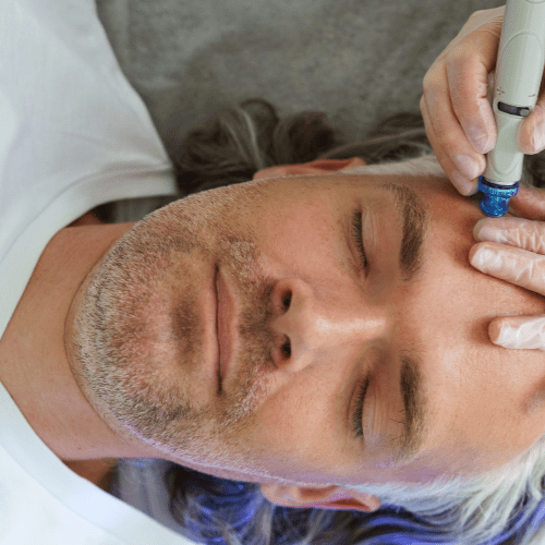 Hydrafacial in Green Bay